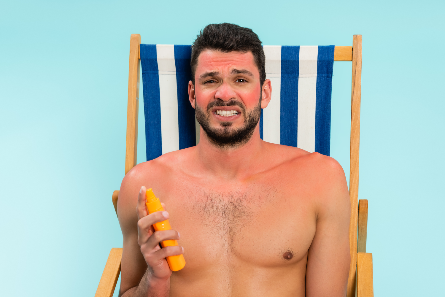 Sunburn